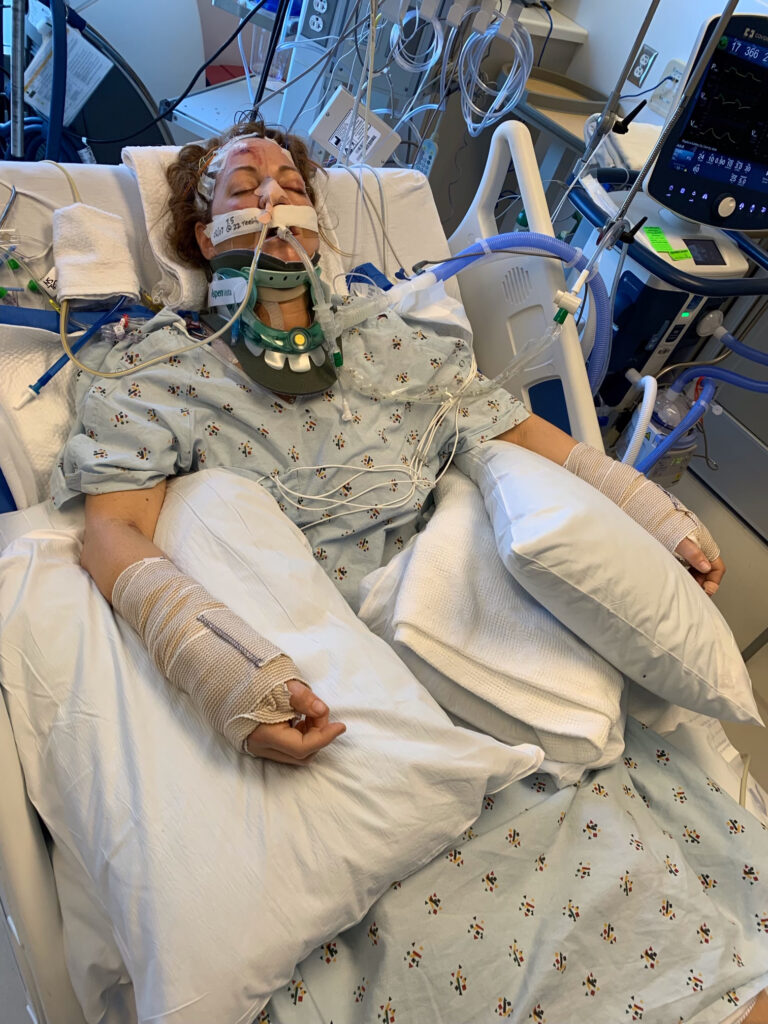 Shannon in Coma at UCLA