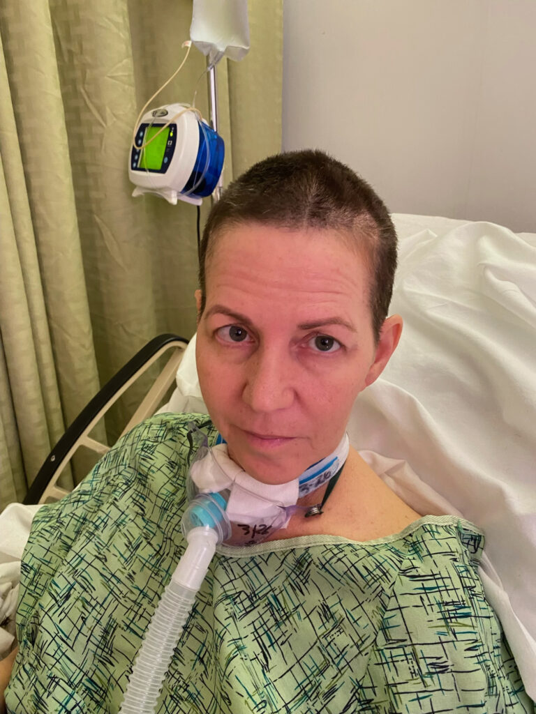 Head shaved and breating through a _trach_ tube
