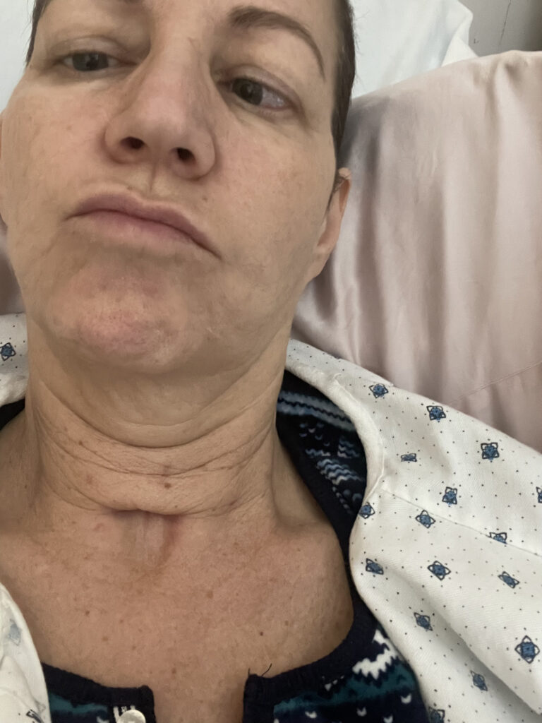 Painful _trach_ scar